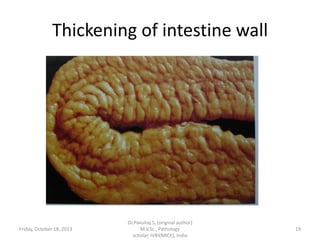 Thickening of intestine wall

Friday, October 18, 2013

Dr.Pavulraj.S, (original author)
M.V.Sc., Pathology
scholar, IVRI(NRCE), India

19

 