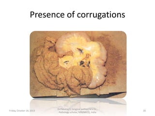 Presence of corrugations

Friday, October 18, 2013

Dr.Pavulraj.S, (original author) M.V.Sc.,
Pathology scholar, IVRI(NRCE), India

20

 