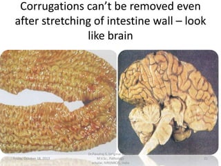 Corrugations can’t be removed even
after stretching of intestine wall – look
like brain

Friday, October 18, 2013

Dr.Pavulraj.S, (original author)
M.V.Sc., Pathology
scholar, IVRI(NRCE), India

21

 