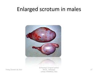 Enlarged scrotum in males

Friday, October 18, 2013

Dr.Pavulraj.S, (original author)
M.V.Sc., Pathology
scholar, IVRI(NRCE), India

27

 