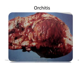 Orchitis

Friday, October 18, 2013

Dr.Pavulraj.S, (original author)
M.V.Sc., Pathology
scholar, IVRI(NRCE), India

28

 