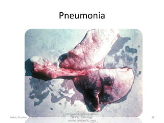 Pneumonia

Friday, October 18, 2013

Dr.Pavulraj.S, (original author)
M.V.Sc., Pathology
scholar, IVRI(NRCE), India

37

 