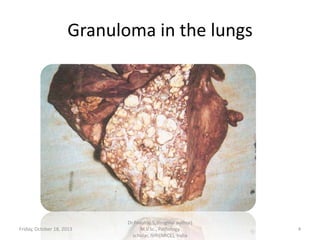 Granuloma in the lungs

Friday, October 18, 2013

Dr.Pavulraj.S, (original author)
M.V.Sc., Pathology
scholar, IVRI(NRCE), India

4

 