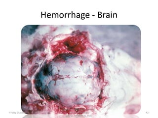 Hemorrhage - Brain

Friday, October 18, 2013

Dr.Pavulraj.S, (original author)
M.V.Sc., Pathology
scholar, IVRI(NRCE), India

42

 