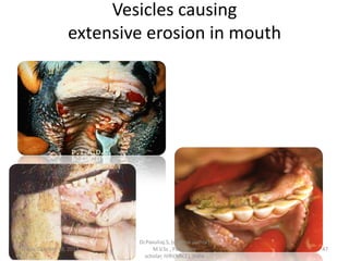 Vesicles causing
extensive erosion in mouth

Friday, October 18, 2013

Dr.Pavulraj.S, (original author)
M.V.Sc., Pathology
scholar, IVRI(NRCE), India

47

 