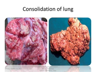 Consolidation of lung

Friday, October 18, 2013

Dr.Pavulraj.S, (original author)
M.V.Sc., Pathology
scholar, IVRI(NRCE), India

5

 