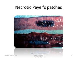 Necrotic Peyer's patches

Friday, October 18, 2013

Dr.Pavulraj.S, (original author)
M.V.Sc., Pathology
scholar, IVRI(NRCE), India

72

 