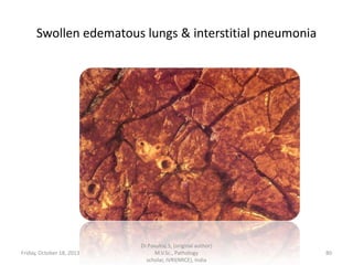 Swollen edematous lungs & interstitial pneumonia

Friday, October 18, 2013

Dr.Pavulraj.S, (original author)
M.V.Sc., Pathology
scholar, IVRI(NRCE), India

80

 