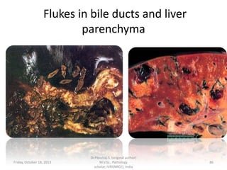 Flukes in bile ducts and liver
parenchyma

Friday, October 18, 2013

Dr.Pavulraj.S, (original author)
M.V.Sc., Pathology
scholar, IVRI(NRCE), India

86

 