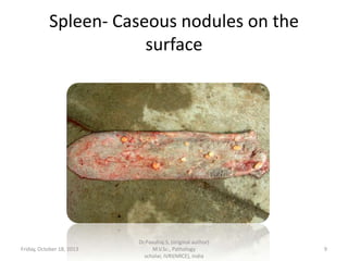 Spleen- Caseous nodules on the
surface

Friday, October 18, 2013

Dr.Pavulraj.S, (original author)
M.V.Sc., Pathology
scholar, IVRI(NRCE), India

9

 