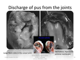Discharge of pus from the joints

Large fibrin clots in the carpal joint
Friday, October 18, 2013

Dr.Pavulraj.S, (original author)
M.V.Sc., Pathology
scholar, IVRI(NRCE), India

Edematous, hyperemic
synovial membrane
93

 