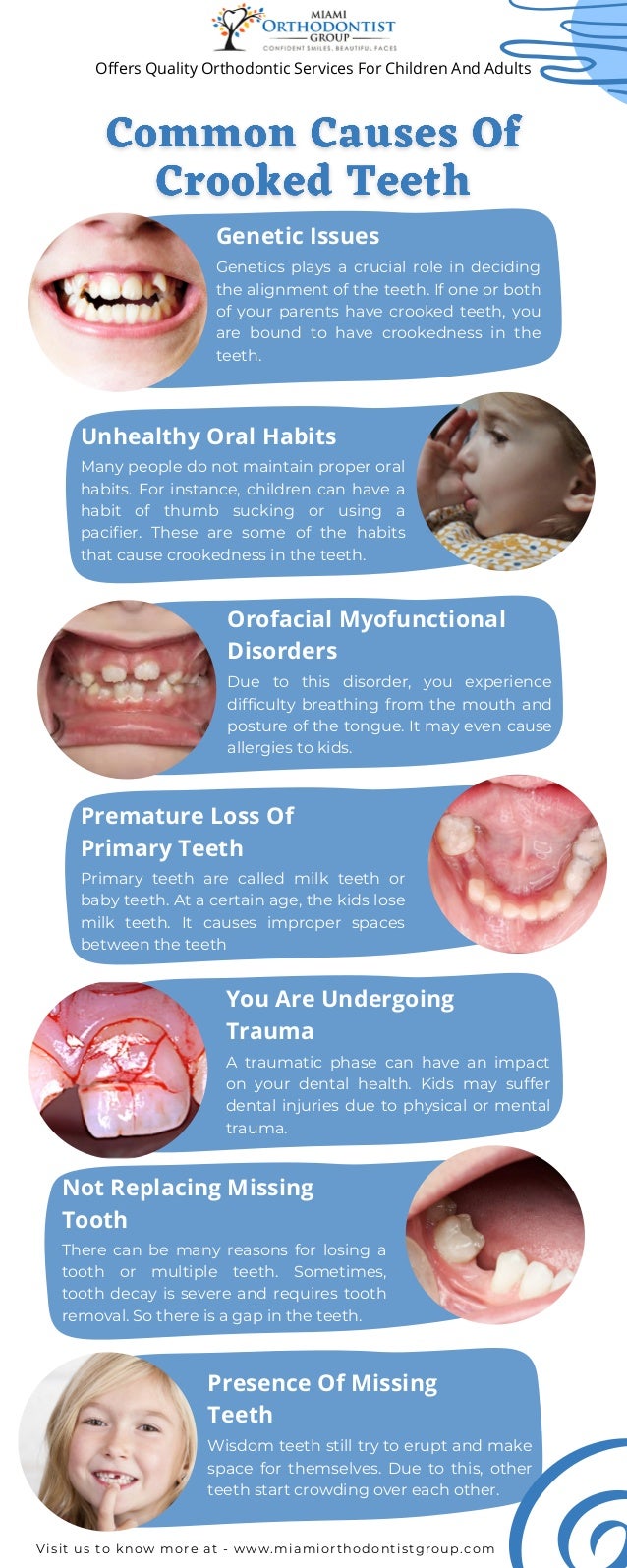Common causes of crooked teeth