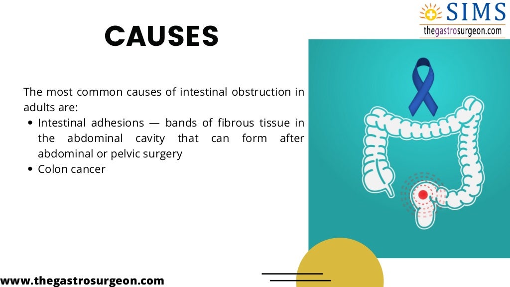 Common causes of intestinal obstruction