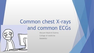 Common chest X-rays
and common ECGs
Maryam Majid Al Ezairej
Collage of medicine
RAKMHSU
 