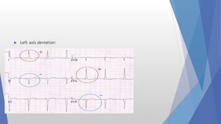 Common chest x rays and common ecgs | PPTX