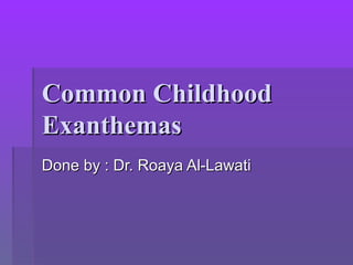 Common ChildhoodCommon Childhood
ExanthemasExanthemas
Done by : Dr. Roaya Al-LawatiDone by : Dr. Roaya Al-Lawati
 