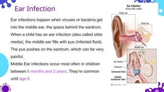 Ear Exploding Pus Common Childhood Illnesses during Winter.pptx