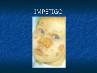 Invatago common childhood infections and rashes (1).ppt