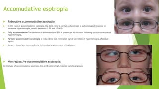 Common children eye disorders | PPTX