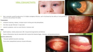 Conjunctivitis Rch Paediatric eye diseases simplified approach | PPTX