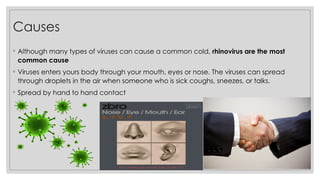Causes
◦ Although many types of viruses can cause a common cold, rhinovirus are the most
common cause
◦ Viruses enters yours body through your mouth, eyes or nose. The viruses can spread
through droplets in the air when someone who is sick coughs, sneezes, or talks.
◦ Spread by hand to hand contact
 