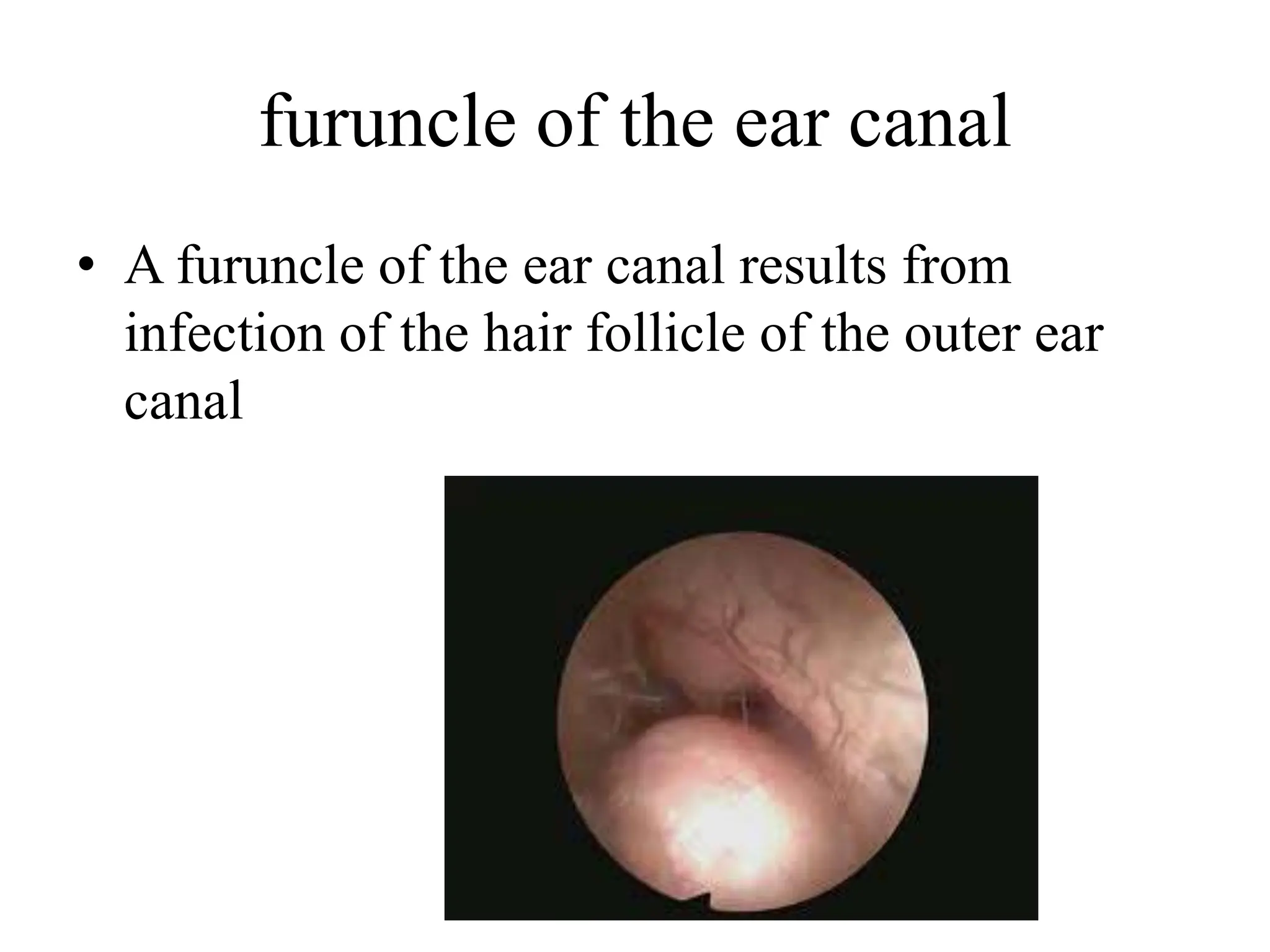 COMMON COMPLICATIONS OF DIABETES IN EAR,NOSE AND THROAT - Copy.pptx