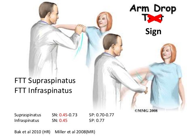 torn rotator cuff test