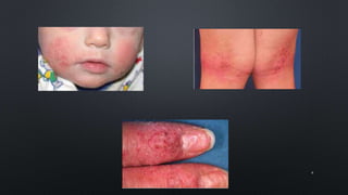 Derma Problem Common Dermatological Problems | PPSX