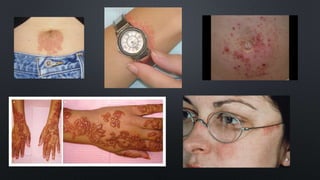 Derma Problem Common Dermatological Problems | PPSX