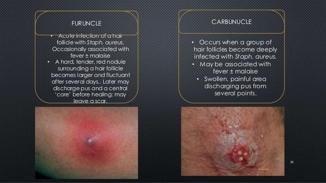 Common Dermatological Problems