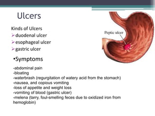 Ulcers
Kinds of Ulcers
duodenal ulcer
esophageal ulcer
gastric ulcer

•Symptoms
-abdominal pain
-bloating
-waterbrash (regurgitation of watery acid from the stomach)
-nausea, and copious vomiting
-loss of appetite and weight loss
-vomiting of blood (gastric ulcer)
-melena (tarry, foul-smelling feces due to oxidized iron from
hemoglobin)
 