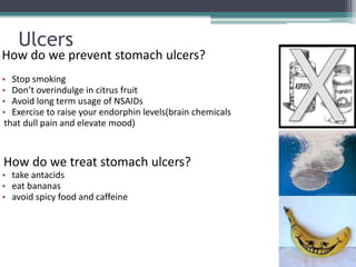 Ulcers
How do we prevent stomach ulcers?
• Stop smoking
• Don’t overindulge in citrus fruit
• Avoid long term usage of NSAIDs
• Exercise to raise your endorphin levels(brain chemicals
 that dull pain and elevate mood)



How do we treat stomach ulcers?
• take antacids
• eat bananas
• avoid spicy food and caffeine
 