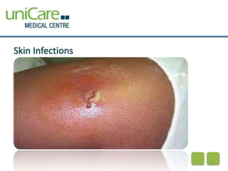 Skin Infections 
16 
 