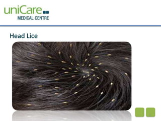 Head Lice 
21 
 