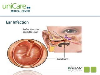 Ear Infection 
9 
 