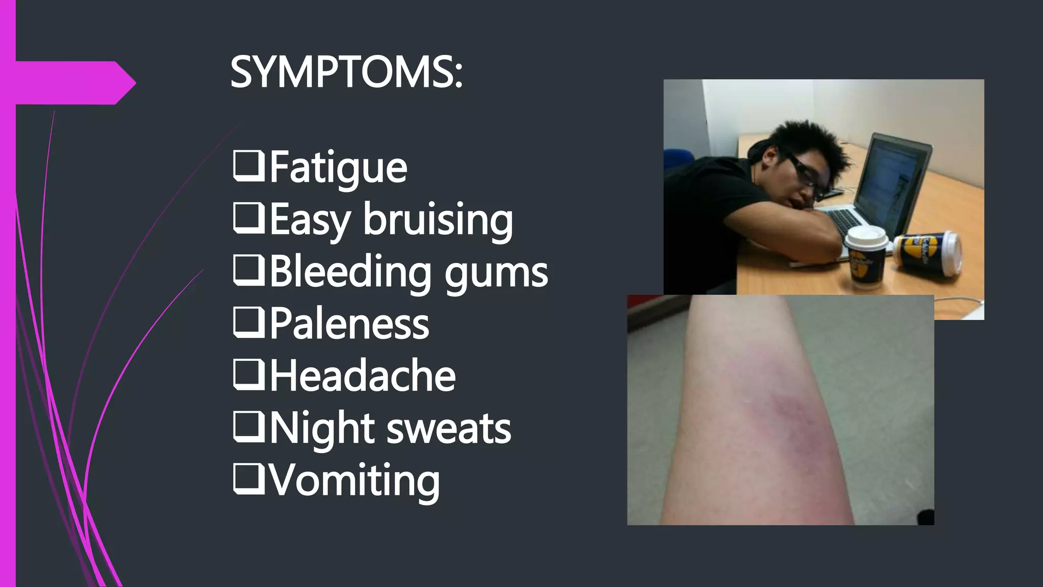 SYMPTOMS:
Fatigue
Easy bruising
Bleeding gums
Paleness
Headache
Night sweats
Vomiting
 