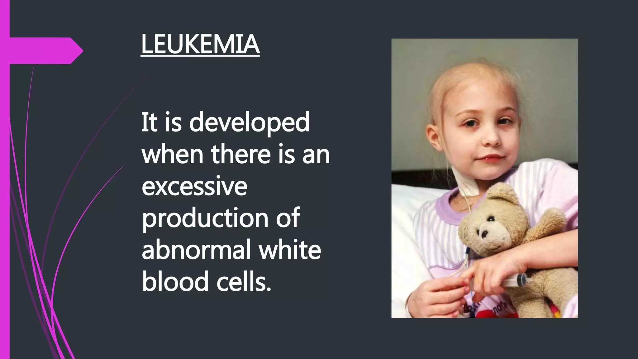LEUKEMIA
It is developed
when there is an
excessive
production of
abnormal white
blood cells.
 
