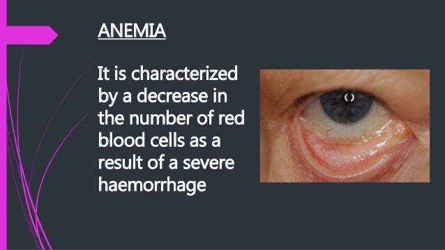 Common diseases of the circulatory system (Lesson 4)