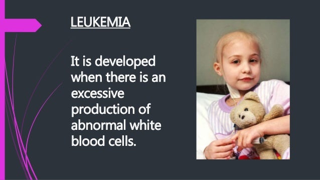 an analysis of the abnormal numbers of white blood cells and the leukemia disease How is leukemia diagnosed blood tests reveal abnormal numbers of white and red blood cells as well as platelets to fight infection and disease the leukemic . an analysis of the abnormal numbers of white blood cells and the leukemia disease How is leukemia diagnosed blood tests reveal abnormal numbers of white and red blood cells as well as platelets to fight infection and disease the leukemic .
