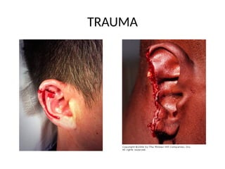 COMMON DISEASES OF THE EXTERNAL AND MIDDLE EAR.pptx