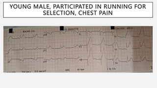 YOUNG MALE, PARTICIPATED IN RUNNING FOR
SELECTION, CHEST PAIN
 