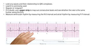 common ecgs appraoch-1.pptx mbbs final year | PPTX
