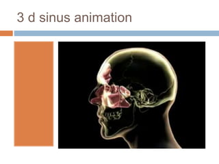 Sinuses Animation Common ent disorders | PPTX
