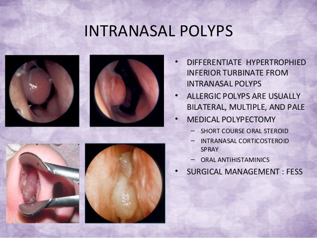 problem bleeding mouth managements Common and problems ent problem bleeding mouth managements Common and problems ent