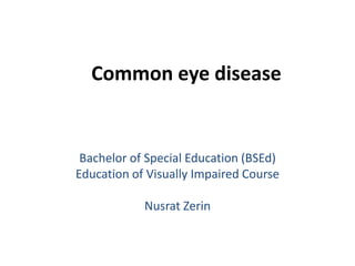 Common eye disease
Bachelor of Special Education (BSEd)
Education of Visually Impaired Course
Nusrat Zerin
 