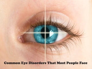 Common Eye Disorders That Most People Face
 