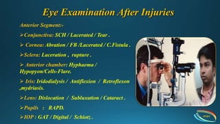 Common eye injury | PPTX