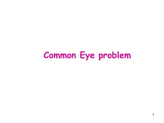 Common Eye problem   