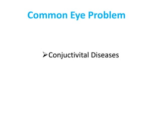 Common Eye Problem
Conjuctivital Diseases
 