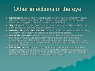 Other infections of the eye
 Chalazion: looks like a small lump on the eyelid, and may occur
when a meibomian gland (an oil-secreting gland in the eyelid)
becomes clogged. It is not caused by infection.
 Stye:looks like a red, sore lump near the edge of the eyelid; it is
caused by an infected eyelash follicle.
 Preseptal or Orbital Cellulitis: is an infection related to trauma,
an upper respiratory infection or an eyelid infection.
 What to look for: The tissues around the eye appear red and
painfully swollen.The child may have a fever. More serious
preseptal or orbital cellulitis infections can cause decreased vision,
an inability to move the eye, and the appearance of the eye being
pushed forward.
 What to do: Both forms of cellulitis are serious conditions that
require urgent medical attention. Take the child to a primary care
doctor or other qualified health professional who will co-manage
the child's treatment with an ophthalmologist.
 
